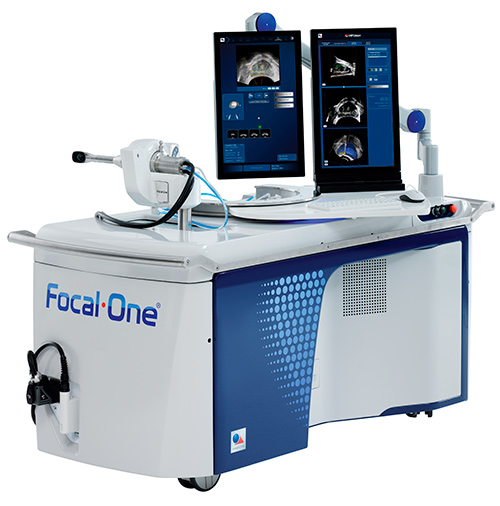 Focal One - Traitement cancer de la prostate